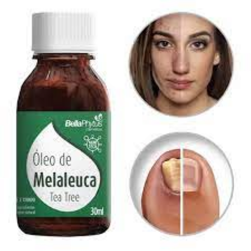 Melaleuca Tea Tree 30ml – O Poder Natural para Sua Pele e Bem-Estar!